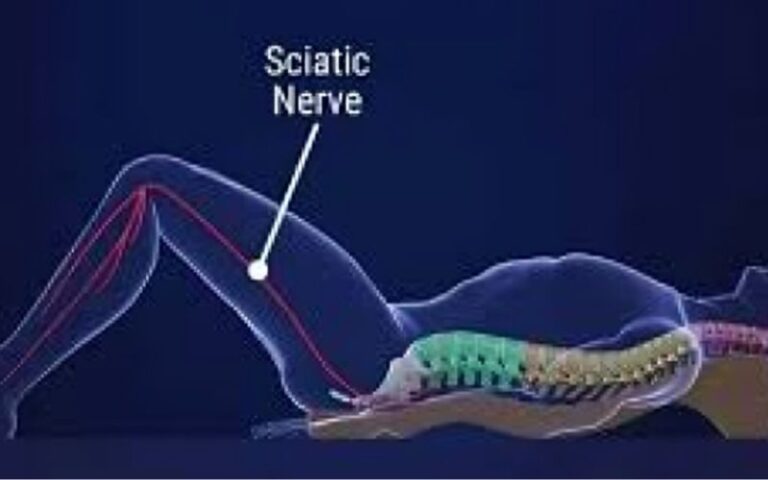 Say Goodbye to Sciatic Nerve Pain in Just 10 Minutes with This Natural Method